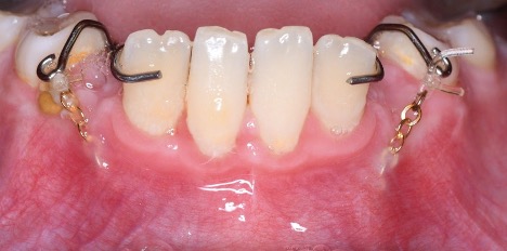 Canine Exposure After