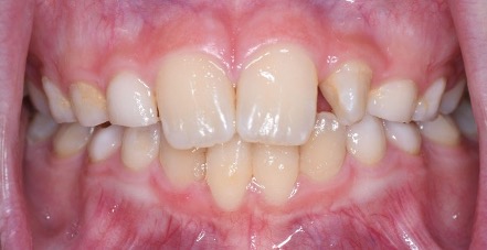 Canine Exposure Before