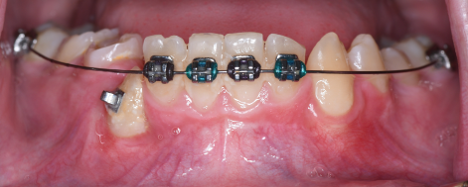 Canine Exposure Additional